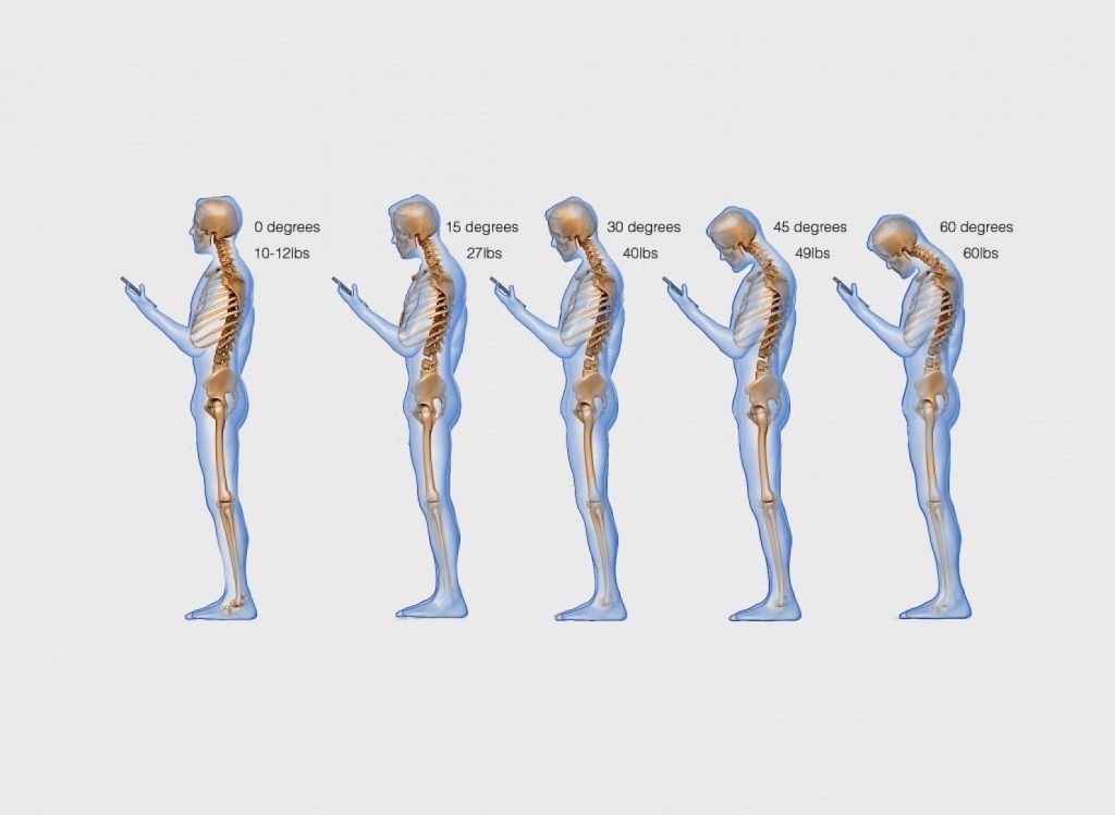 text neck